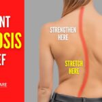 Best Scoliosis Exercises for Pain and Posture (NO EQUIPMENT!)