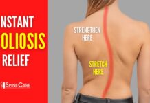 Best Scoliosis Exercises for Pain and Posture (NO EQUIPMENT!)
