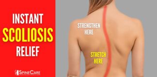 Best Scoliosis Exercises for Pain and Posture (NO EQUIPMENT!)
