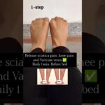 Varicose veins, back pain, sciatica pain relief ✅ #backpainrelief #sciatica #vericoseveins #exercise