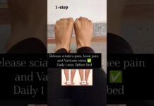Varicose veins, back pain, sciatica pain relief ✅ #backpainrelief #sciatica #vericoseveins #exercise