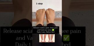 Varicose veins, back pain, sciatica pain relief ✅ #backpainrelief #sciatica #vericoseveins #exercise