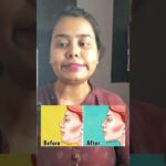 Day 11 of #30dayschallenge of #faceyoga #skincare #yoga #faceyogaexercises #ytshorts #shorts