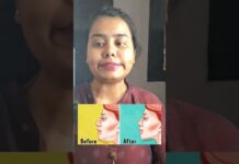 Day 11 of #30dayschallenge of #faceyoga #skincare #yoga #faceyogaexercises #ytshorts #shorts