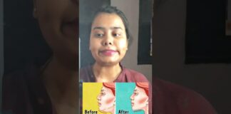 Day 11 of #30dayschallenge of #faceyoga #skincare #yoga #faceyogaexercises #ytshorts #shorts