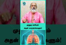 sciatica pain relief – krishnan balaji #shorts #shortvideo #cosmohealth